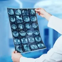 Manipal Hospitals Radiology Group (MHRG) |  Manipal Hospitals, India