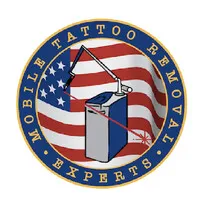 Mobile Tattoo Removal Experts
