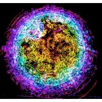 IVF20.ai