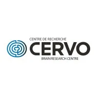 CERVO Brain research centre