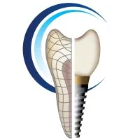 Georgia Prosthodontics - Smile Specialists