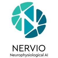 Nervio