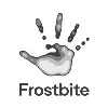 Frostbite Frostbite