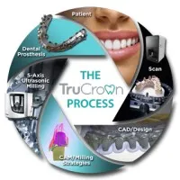 TruCrown