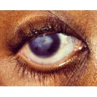 Vision4Change (previously known as AMT Community Development)