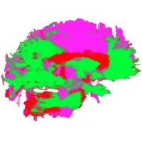 SymBizzNet