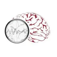 Neural Engineering Data Consortium