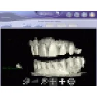 Brontes Technologies