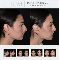 East Coast Aesthetic Surgery, Inc.