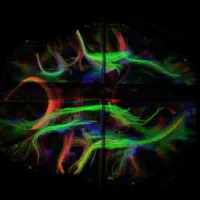 MIND Laboratory (Music, Imaging, and Neural Dynamics)