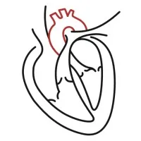 QHeart Medical