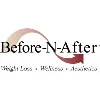 Before-N-After Before-N-After