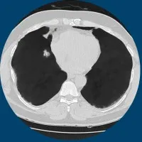 Riverain Technologies