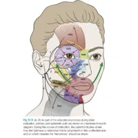 International Facial Nerve Group International Facial Nerve Group