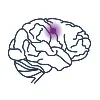 Brain Sentinel, Inc. Brain Sentinel, Inc.