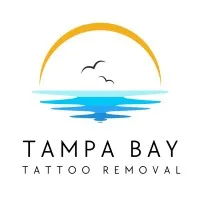 Tampa Bay Tattoo Removal